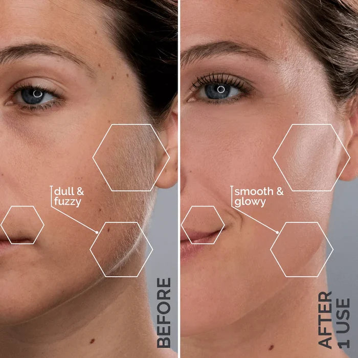 Side-by-side comparison of a woman's cheek before and after using the Michael Todd Beauty Dermaplaning Essentials Kit shows dull, fuzzy skin on the left and smooth, glowing skin on the right.