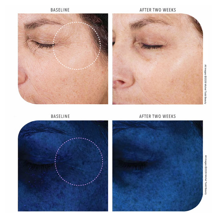 Before and after comparison of skin texture on a person's face and neck.
