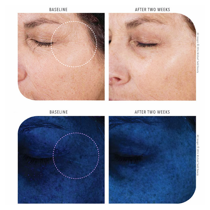 The woman's eyes show a noticeable improvement after using Michael Todd Beauty's Knú Serum.