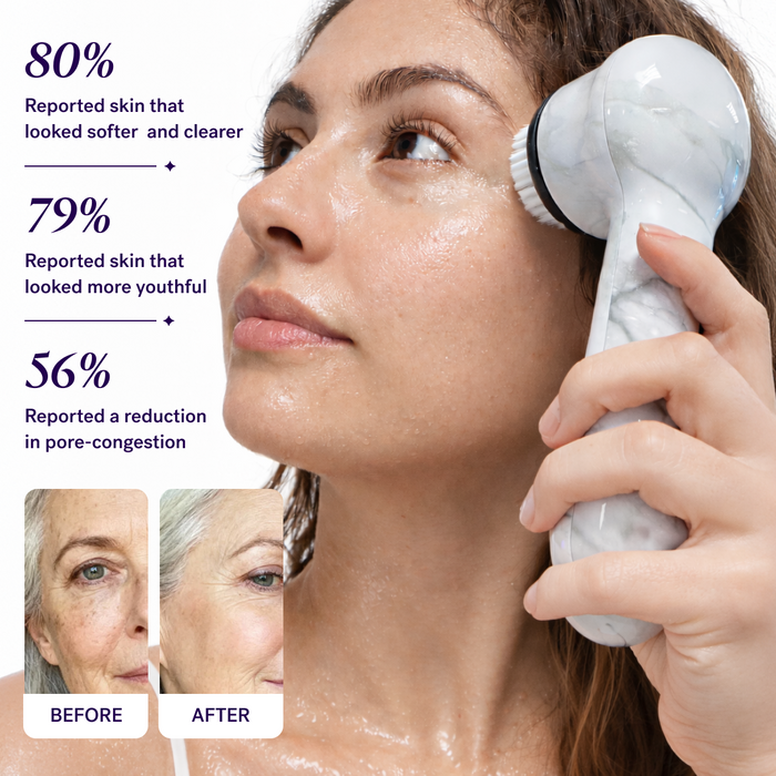 White Marble A woman uses the Michael Todd Beauty Soniclear sonic cleansing facial brush on her cheek; user-reported skin improvements and before-and-after photos reveal noticeable results.